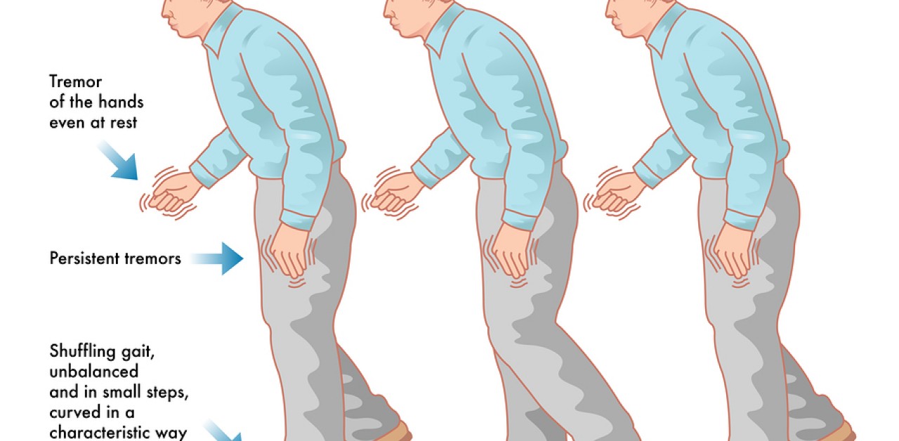 How can we reduce the symptoms of Parkinson's disease?