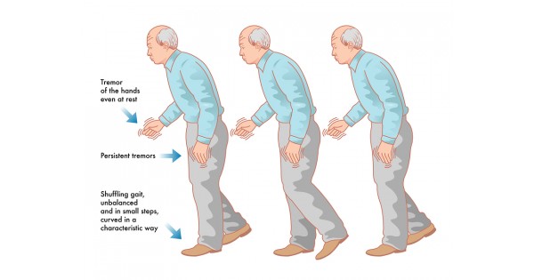 doctor prescribed semaglutide metairie Healthy Weight Loss Medication Program